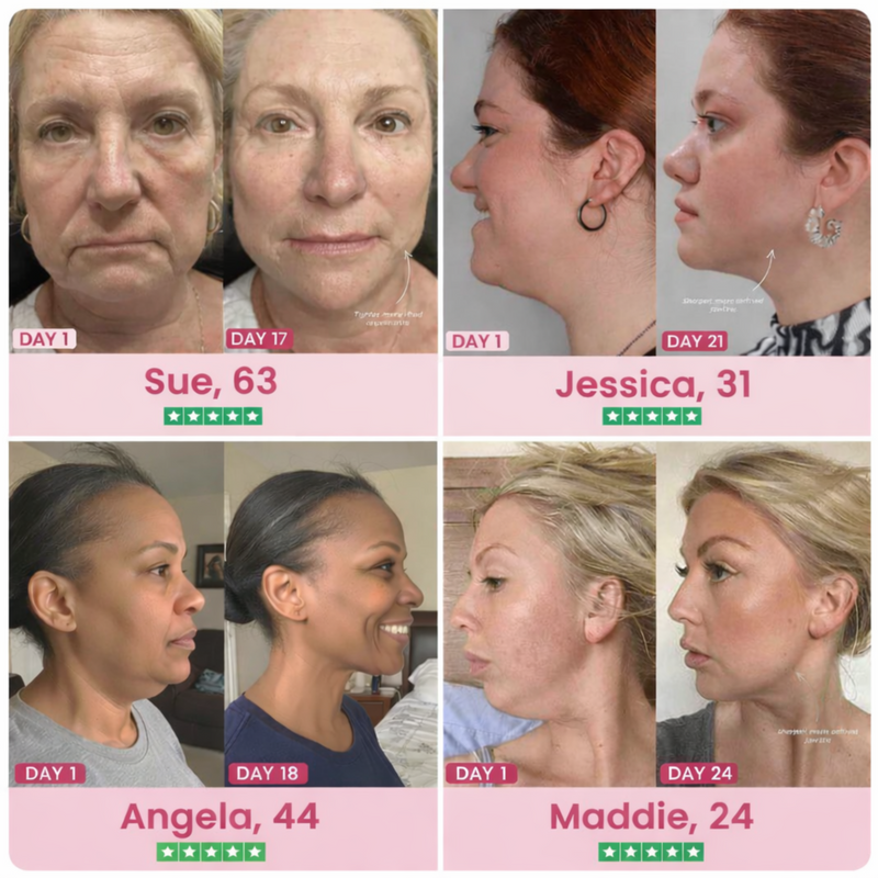 Jawglow collagen mask